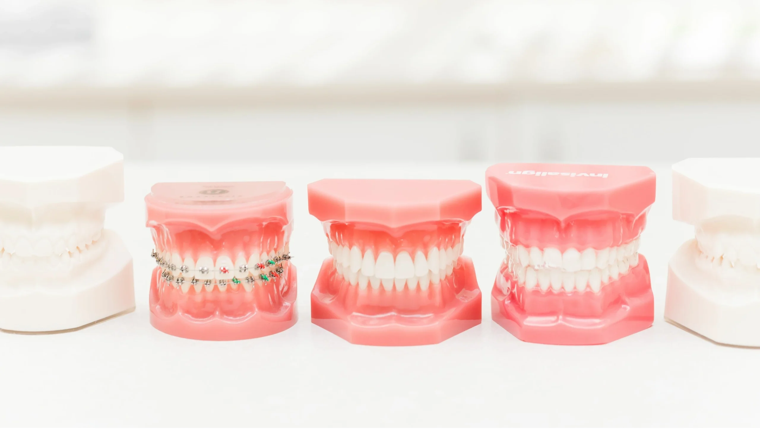 Orthodontiste Docteur Capela Fecamp orthodontie