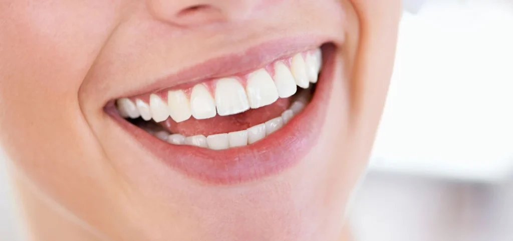 Orthodontie Fécamp Bolbec 76400 - Docteur Camille Capela