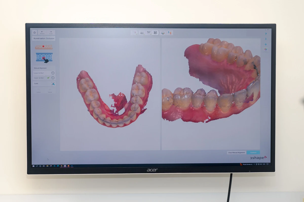 scanner-intra-oral