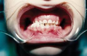 consulter un orthodontiste
